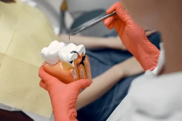 Endodonție